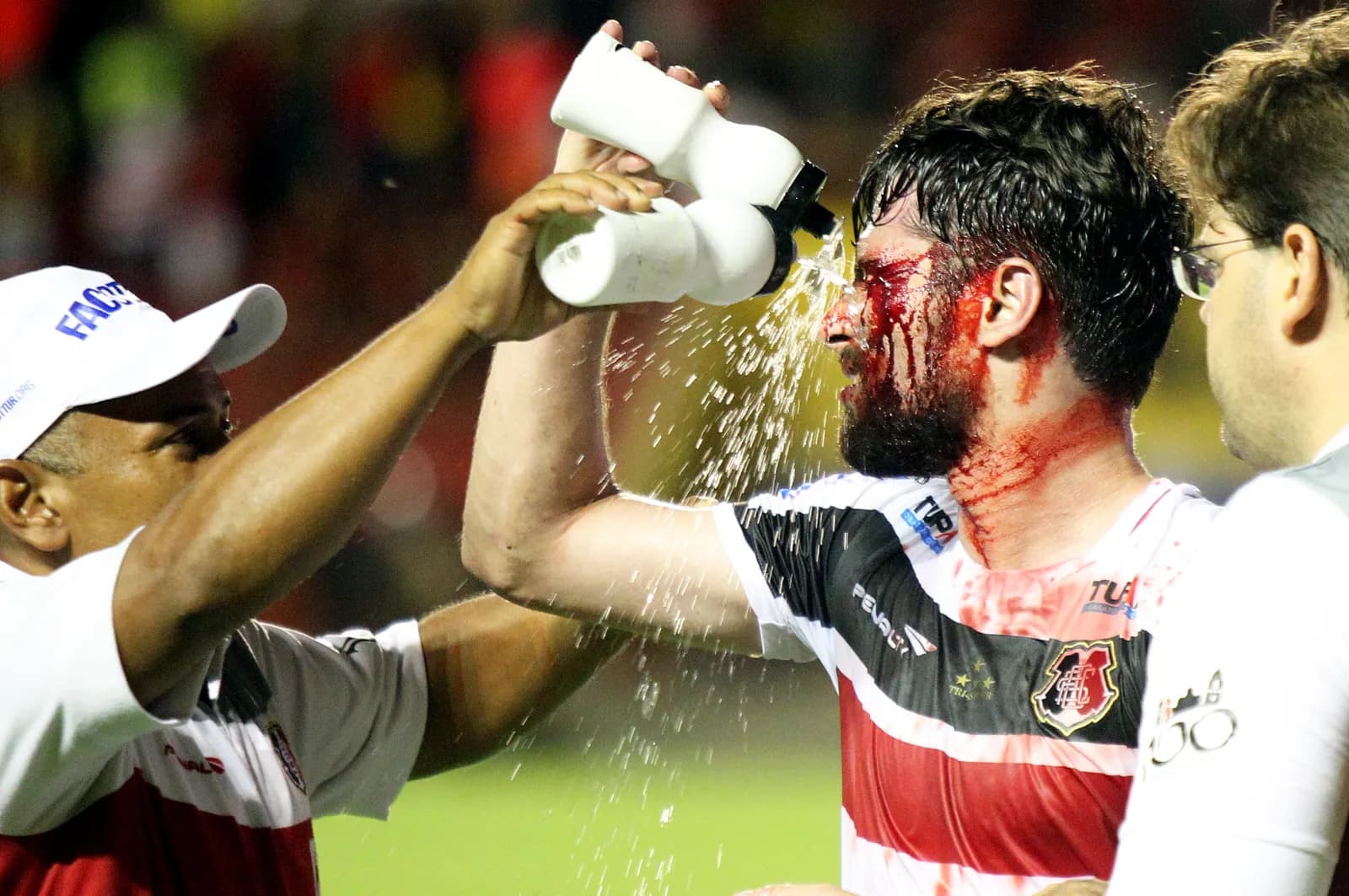 João Paulo: Guerreiro de corpo (sangue) e alma